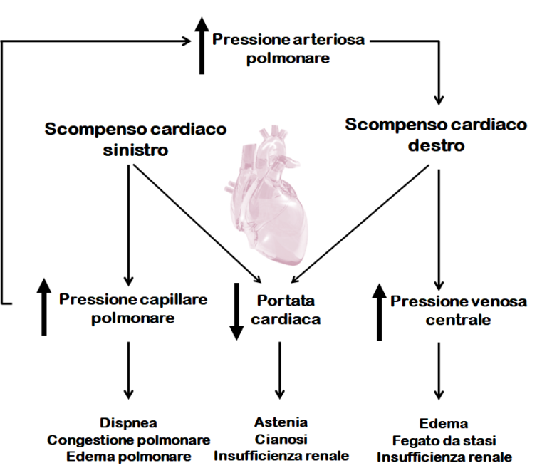 Lo cardiaco destro entità misconosciuta ma sempre attuale